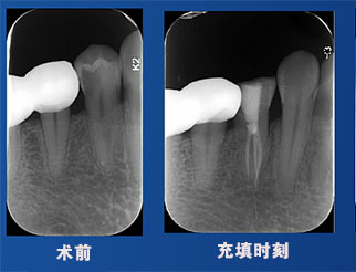 马月英先生案例